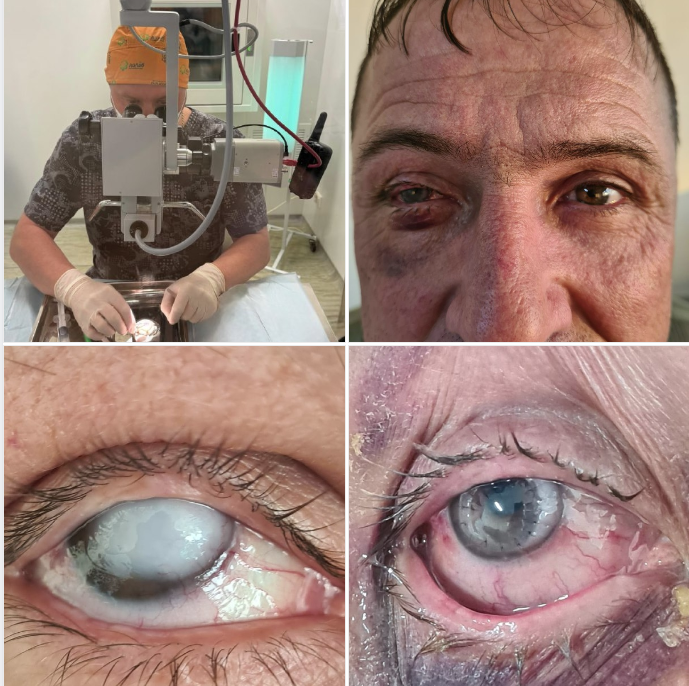 Клинический случай из практики нашей больницы